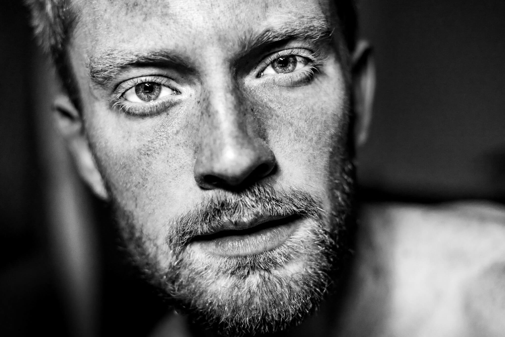 Tips tegen puistjes op gezicht, dit zijn de beste tips! - Activeskin