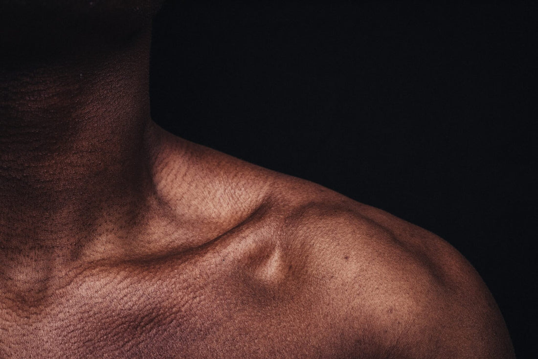Puistjes in je nek? Met deze 3 tips kom je ervan af! - Activeskin