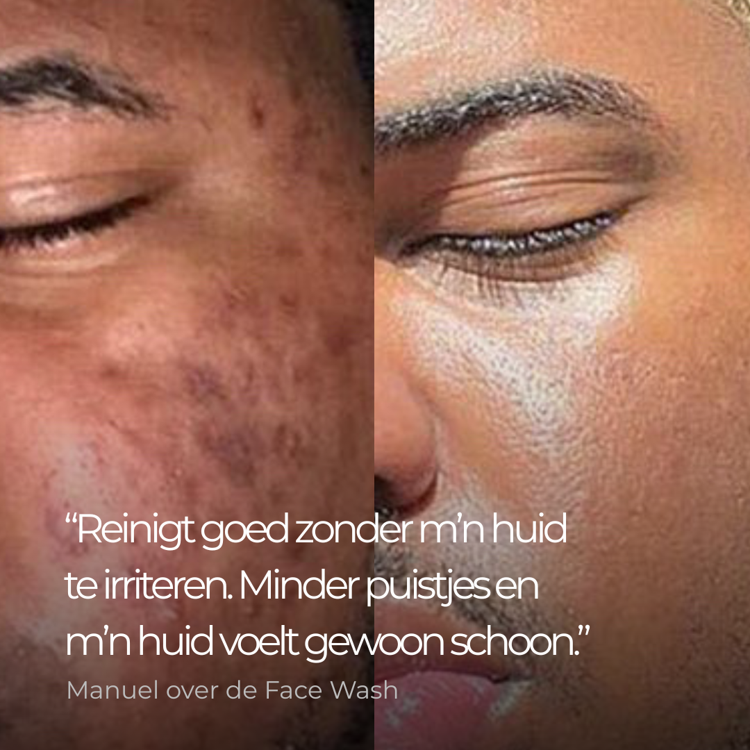 Face Wash - Gezichtsreiniger Mannen met Glycerine tegen Acne & Puistjes