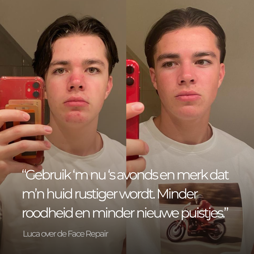 Face Repair - Nachtcreme Mannen met Hyaluronzuur tegen Acne & Puistjes