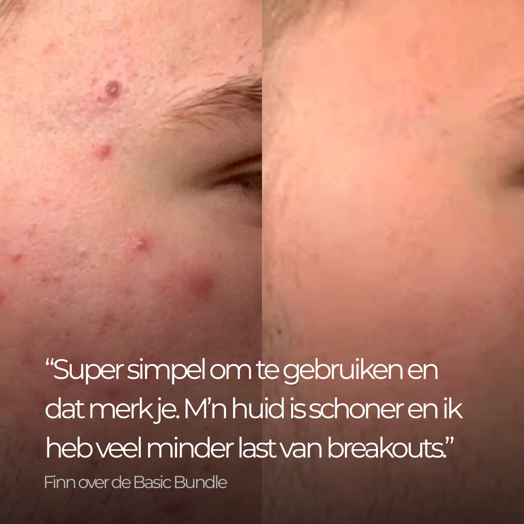 Basic Bundle – Basis Acne Routine met Face Wash & Dagcrème tegen Onzuiverheden & Puistjes
