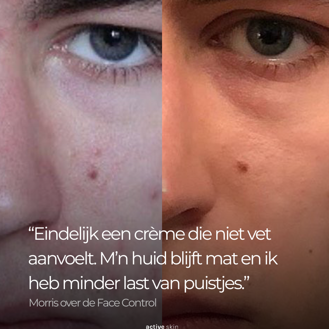 Face Control - Dagcrème Mannen met Retinol en Zink tegen Acne & Onzuiverheden