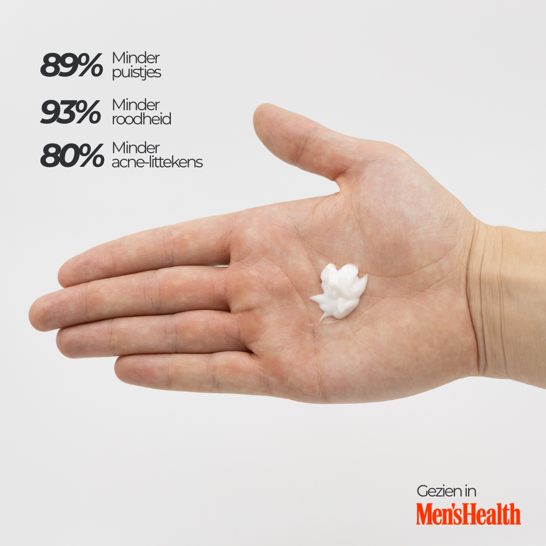 Face Bundle - Complete Acne Verzorgingsroutine met Face Wash, Dag- & Nachtcrème