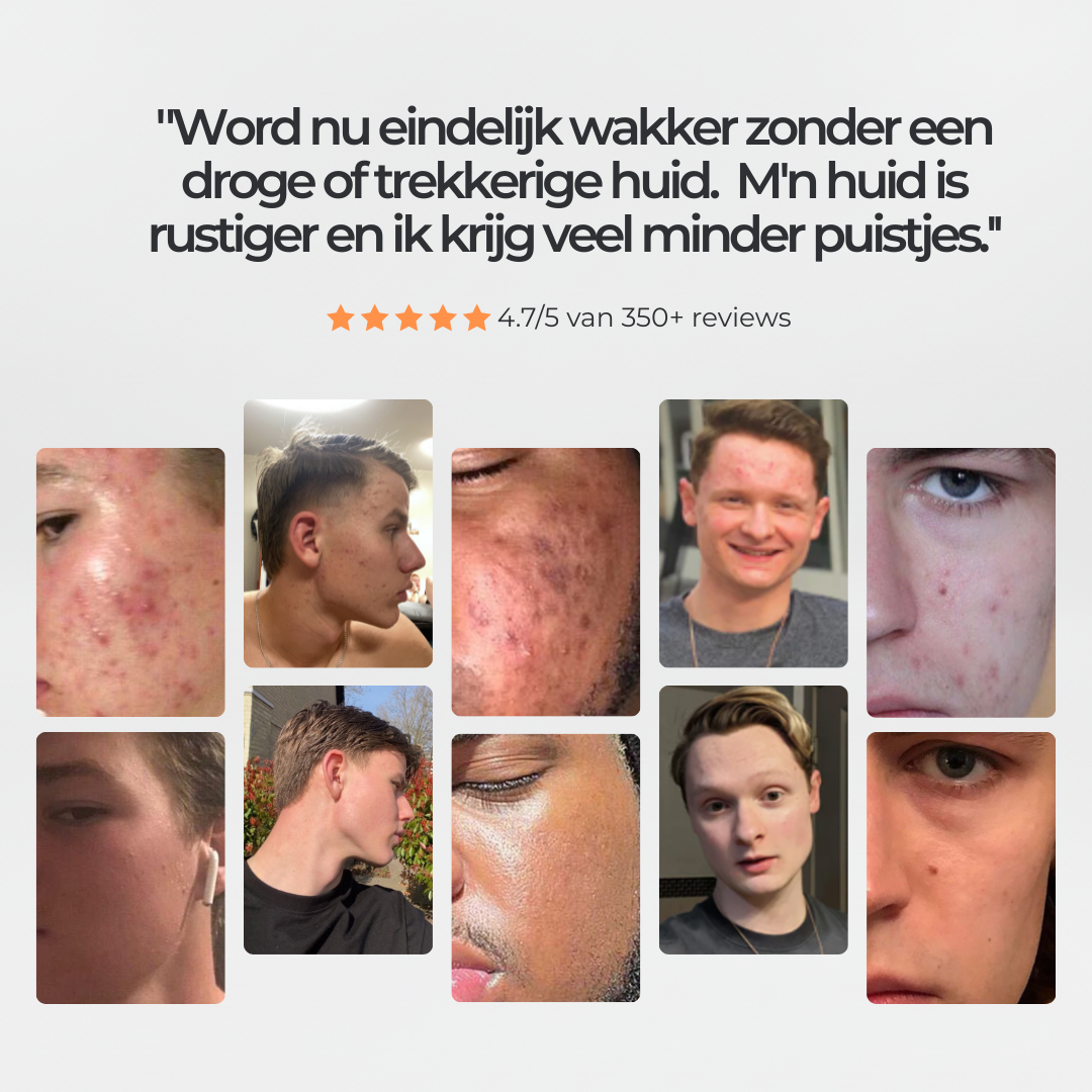 Face Repair - Nachtcreme Mannen met Hyaluronzuur tegen Acne & Puistjes