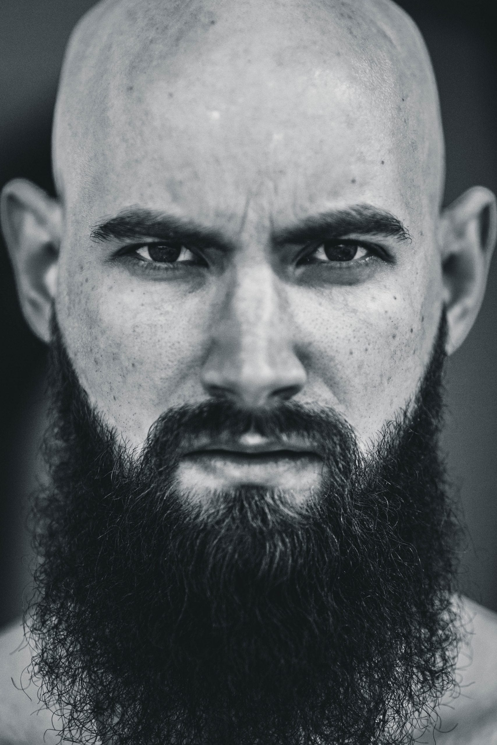 Acne littekens verwijderen, wat is de best manier? - Activeskin