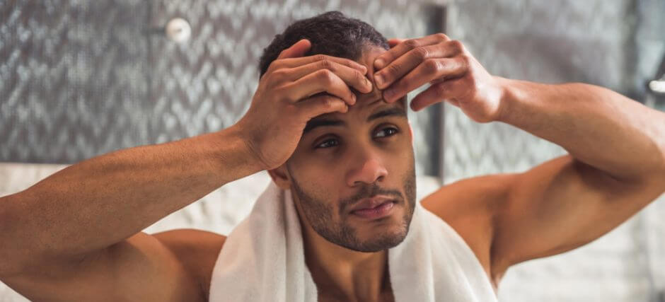 Puistjes uitknijpen of niet? Dit zijn de 5 beste tips! - Activeskin