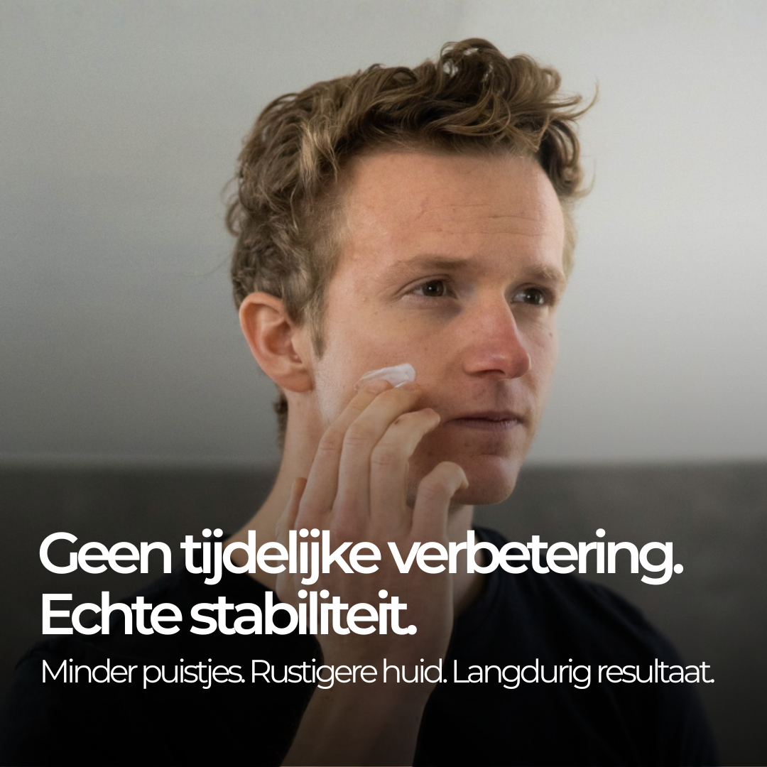 Face Bundle - Complete Acne Verzorgingsroutine met Face Wash, Dag- & Nachtcrème