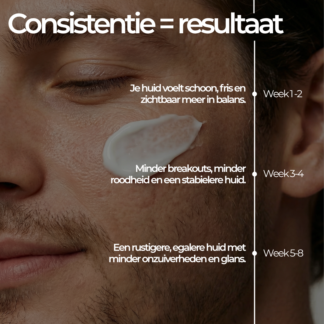 Face Bundle - Complete Acne Verzorgingsroutine met Face Wash, Dag- & Nachtcrème