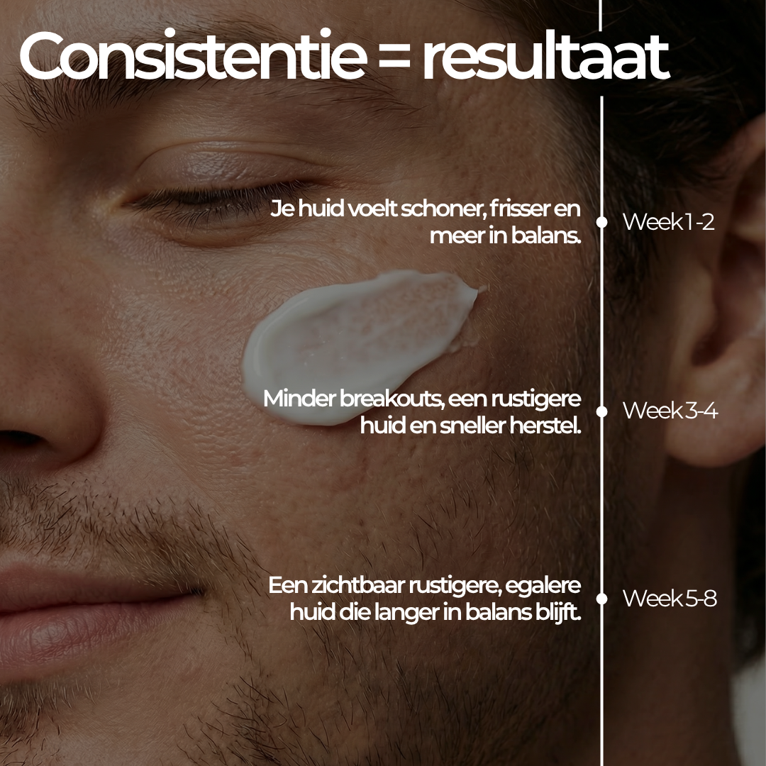 Face Control - Dagcrème Mannen met Retinol en Zink tegen Acne & Onzuiverheden