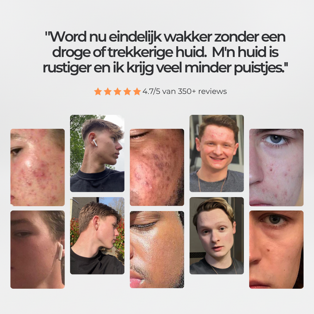 Face Repair - Nachtcreme Mannen met Hyaluronzuur tegen Acne & Puistjes